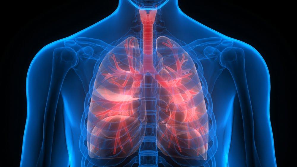 Blue and red lung x-ray representation implicating inflammation in lungs