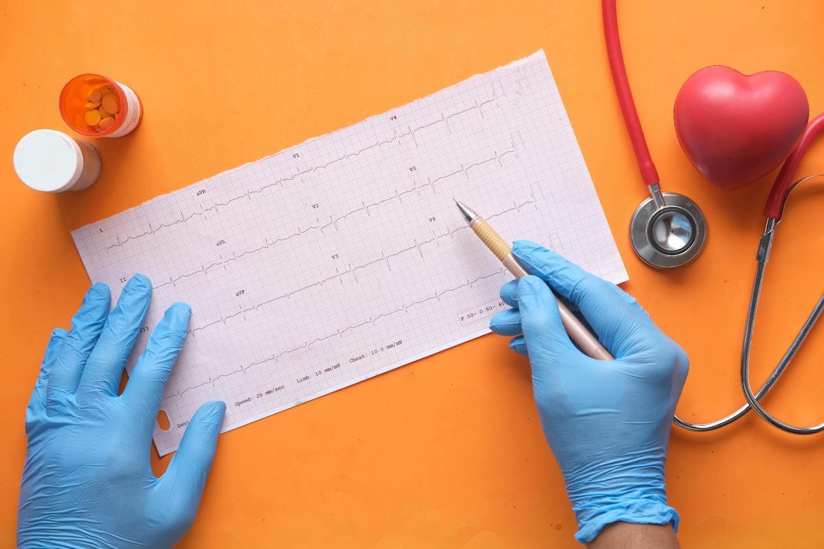 Hands wearing blue medical gloves analyzing an electrocardiogram (EKG) printout with a pen, alongside a stethoscope, heart model, and pill bottles on an orange background.