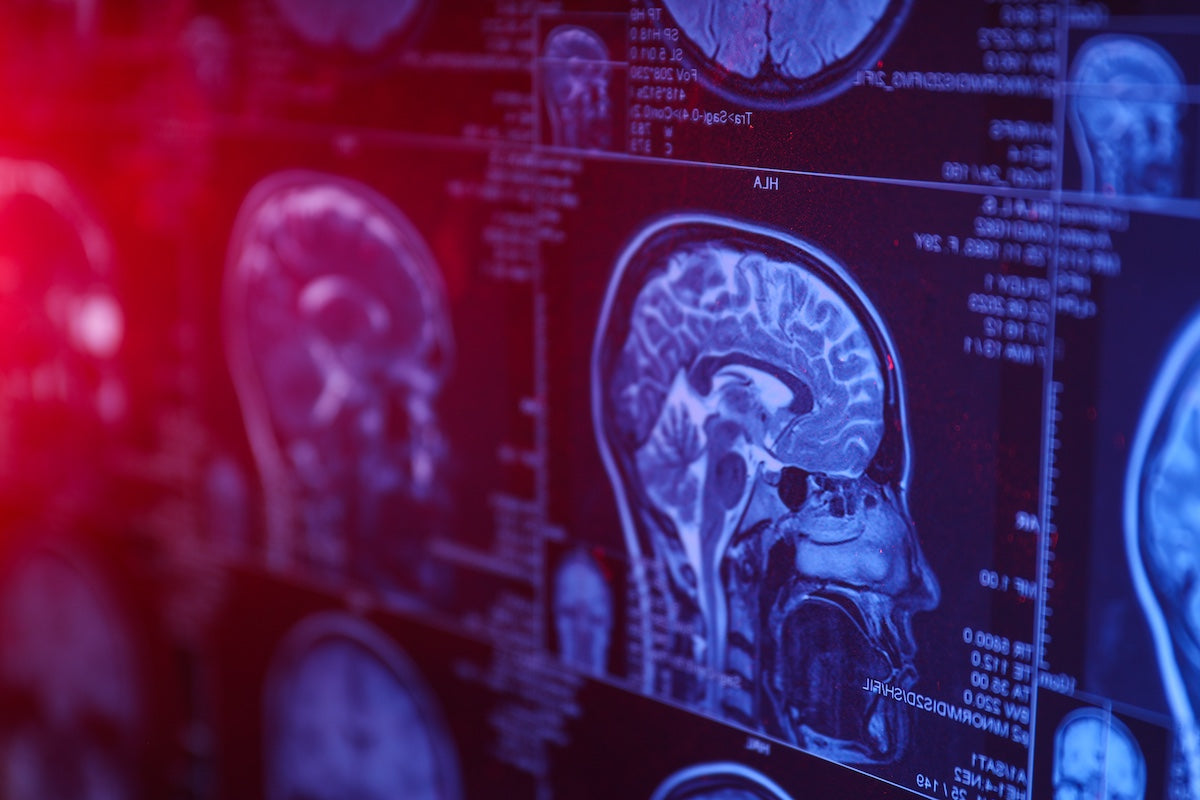 MRI scans of the human brain displayed on a screen, showing detailed cross-sectional images of brain anatomy with a red gradient light overlay on the left side.